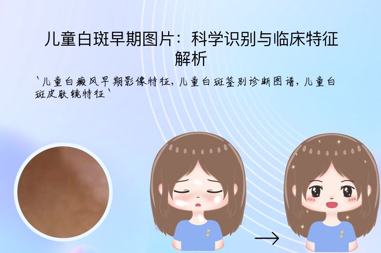 儿童白斑早期图片:科学识别与临床特征解析