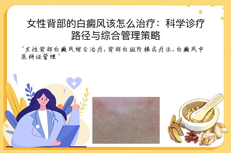 女性背部的白癜风该怎么治疗:科学诊疗路径与综合管理策略