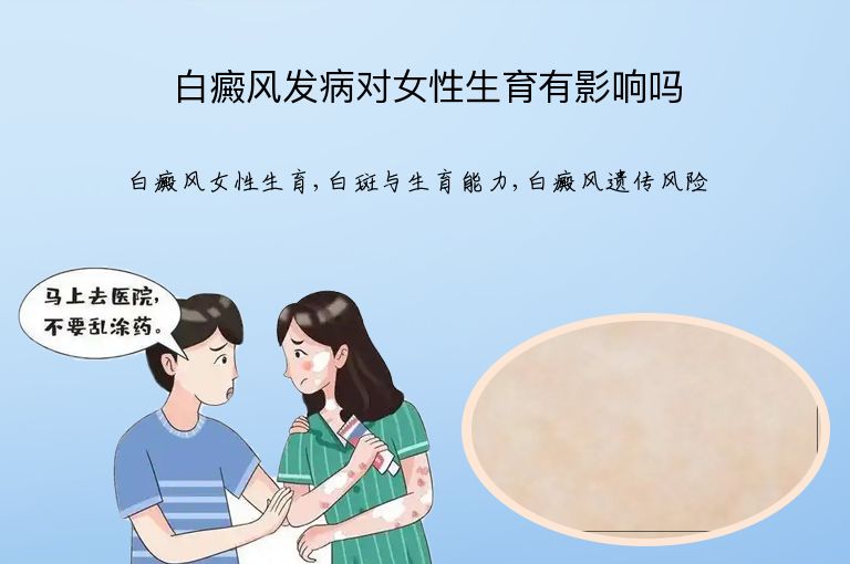 白癜风发病对女性生育有影响吗”