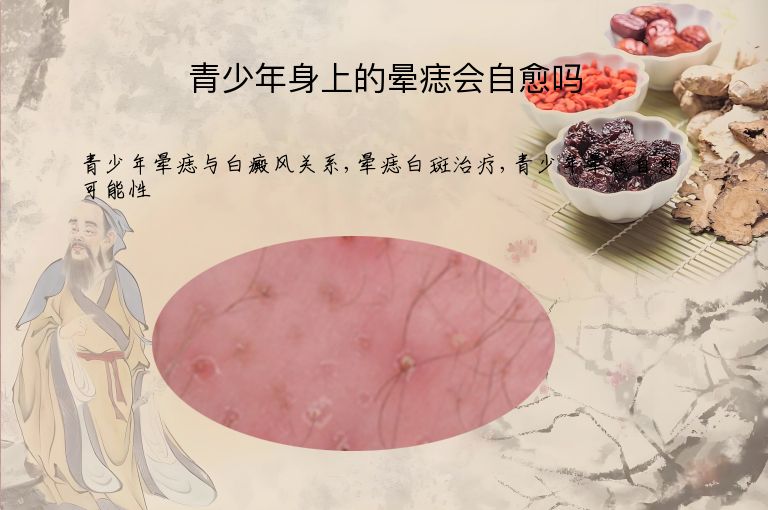青少年身上的晕痣会自愈吗”