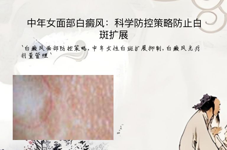 中年女面部白癜风：科学防控策略防止白斑扩展”