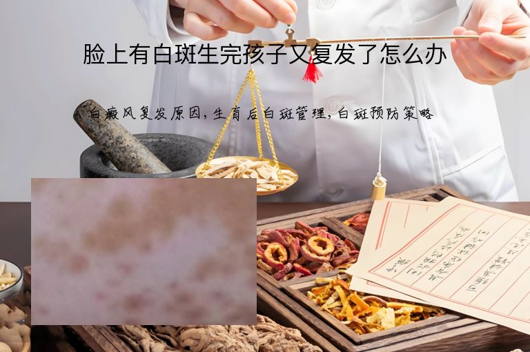 https://www.bdfsjzyy.com/d/file/p/0424847bc679f0c5c5f9f665a51e98b3.jpeg