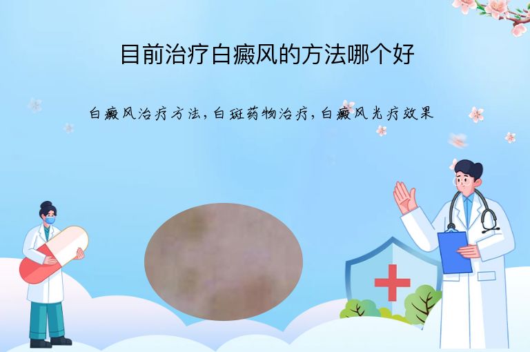 目前治疗白癜风的方法哪个好”