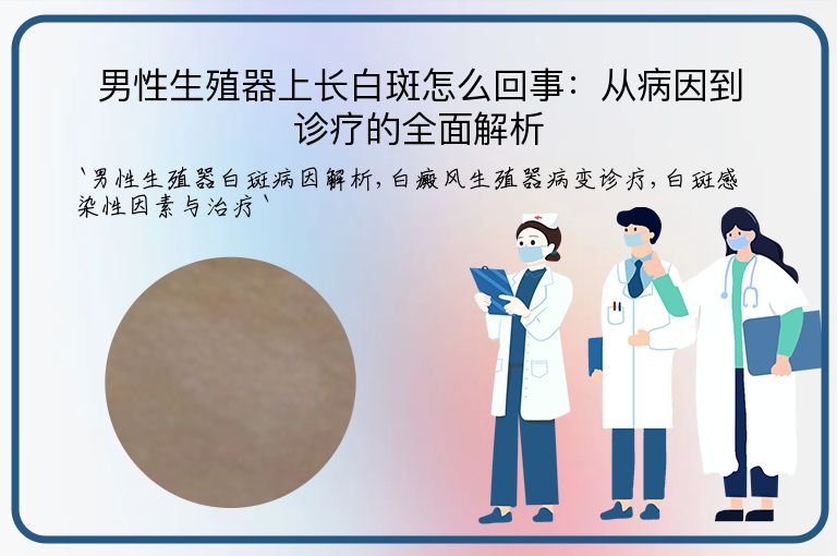 男性生殖器上长白斑怎么回事：从病因到诊疗的全面解析
