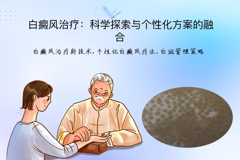 白癜风治疗：科学探索与个性化方案的融合”