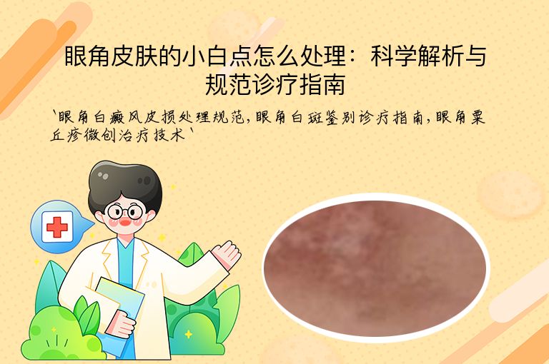 眼角皮肤的小白点怎么处理：科学解析与规范诊疗指南