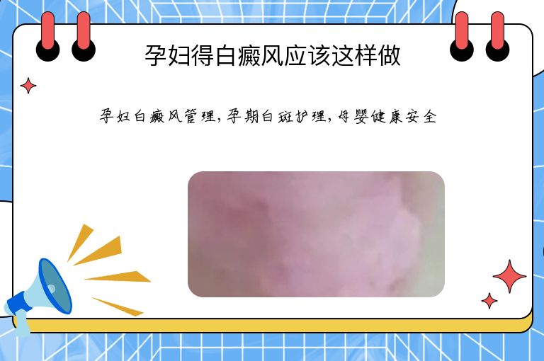 孕妇得白癜风应该这样做”