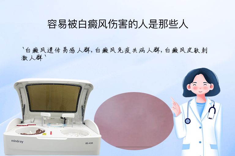 容易被白癜风伤害的人是那些人”
