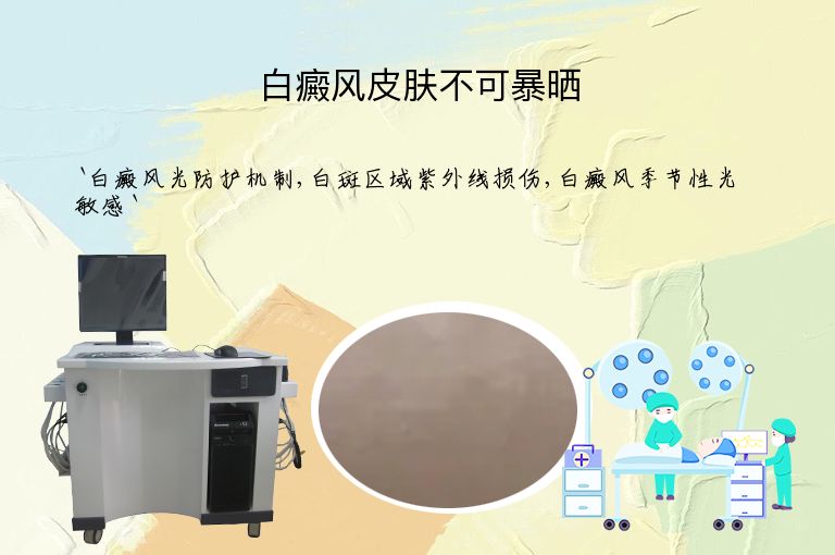 白癜风皮肤不可暴晒