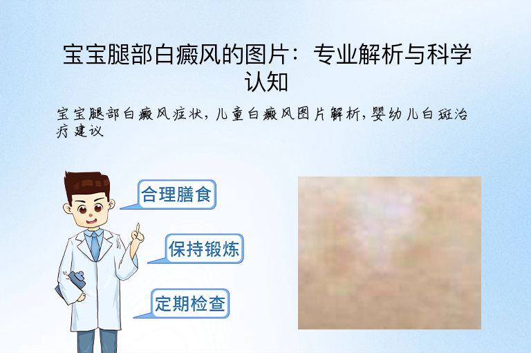 宝宝腿部白癜风的图片：专业解析与科学认知”