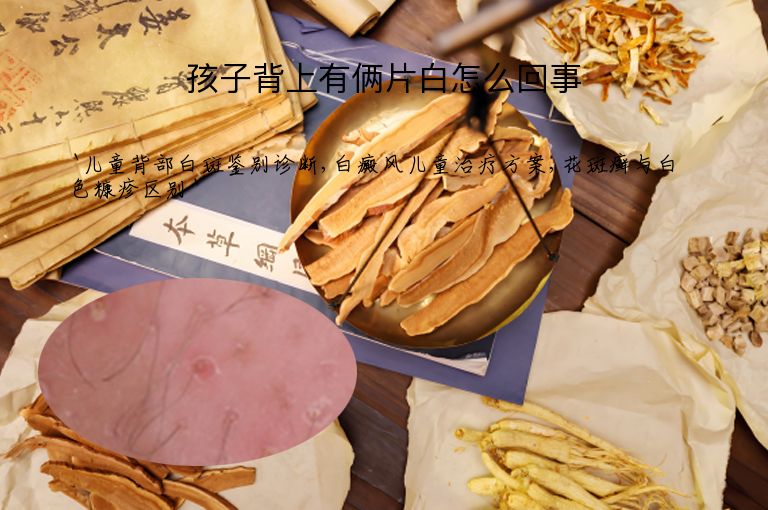 孩子背上有俩片白怎么回事