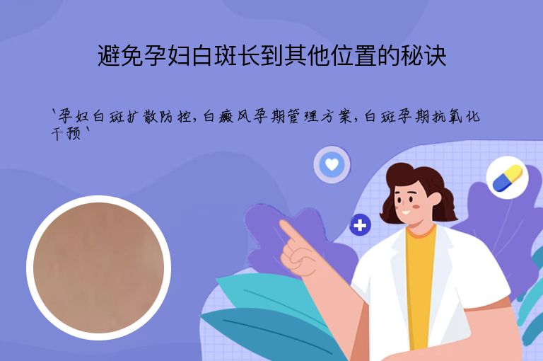 避免孕妇白斑长到其他位置的秘诀