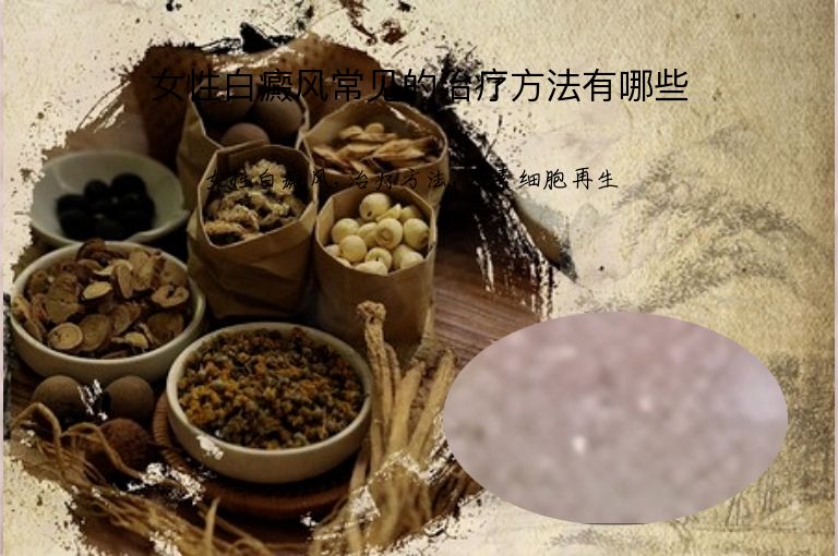 女性白癜风常见的治疗方法有哪些”
