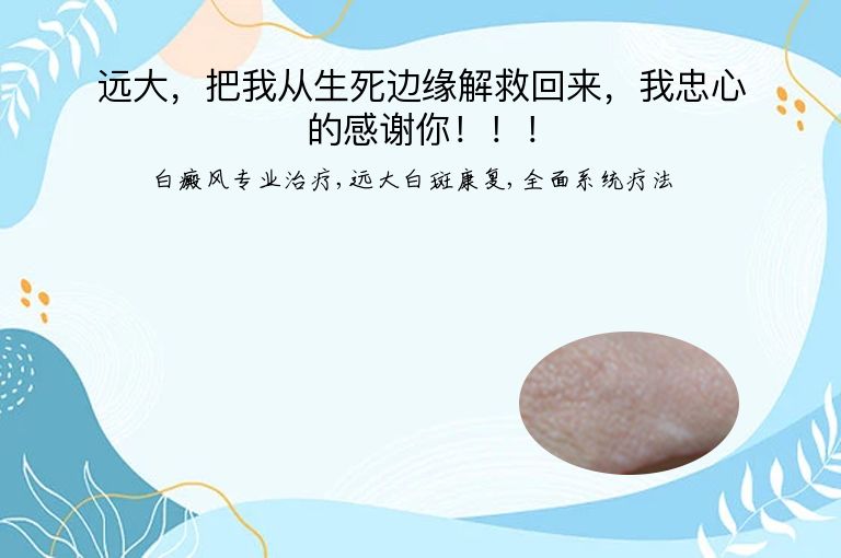 远大,把我从生死边缘解救回来,我忠心的感谢你!!!”