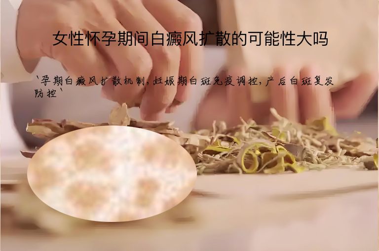 https://www.bdfsjzyy.com/d/file/p/48bbb4c2a490e65d3cf423835db33a41.jpeg