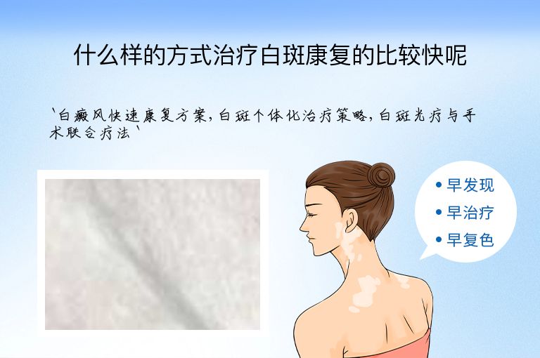 什么样的方式治疗白斑康复的比较快呢