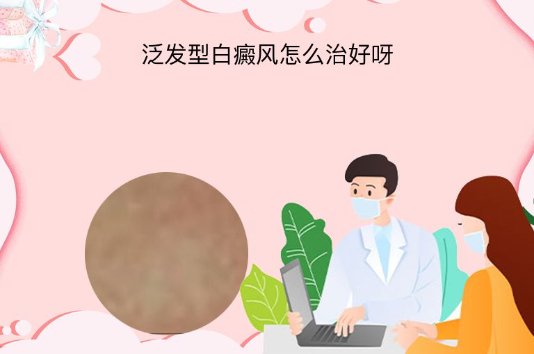 泛发型白癜风怎么治好呀”