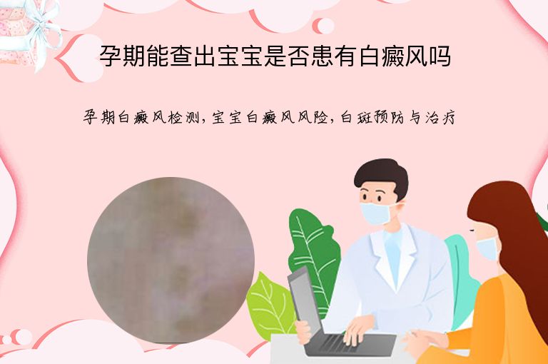 孕期能查出宝宝是否患有白癜风吗”