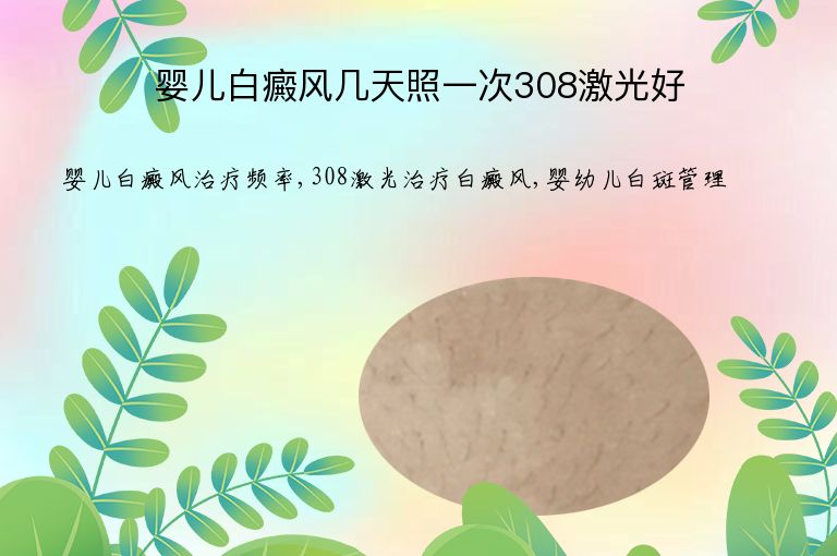 婴儿白癜风几天照一次308激光好”