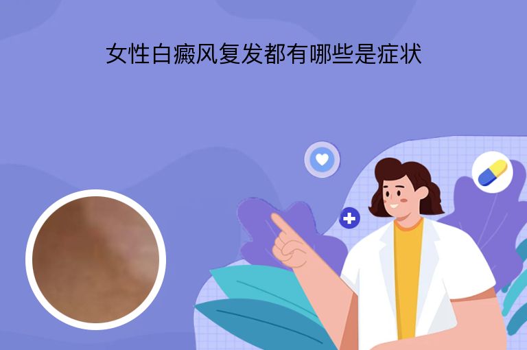 女性白癜风复发都有哪些是症状
