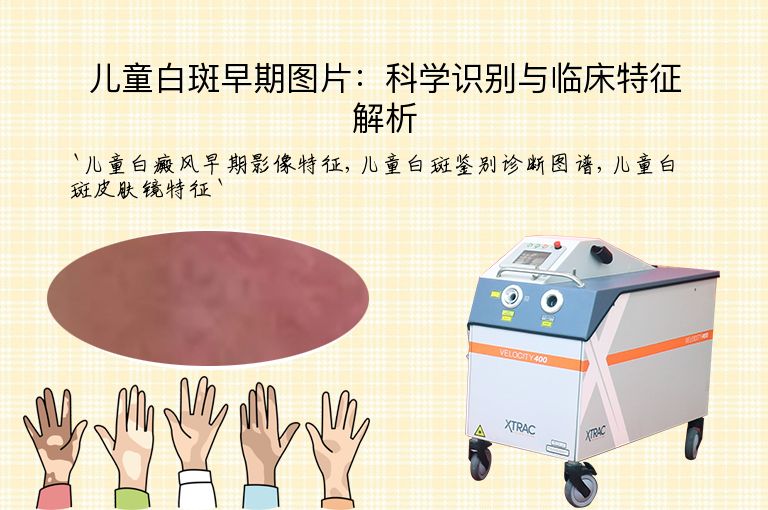 儿童白斑早期图片:科学识别与临床特征解析