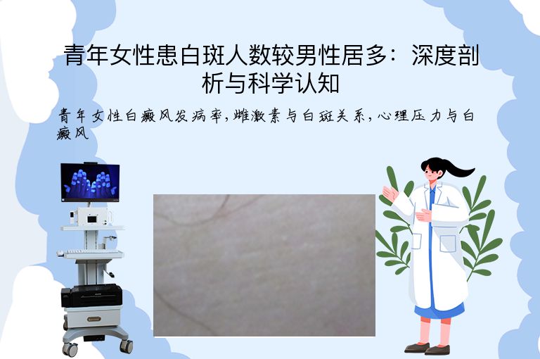 青年女性患白斑人数较男性居多:深度剖析与科学认知”