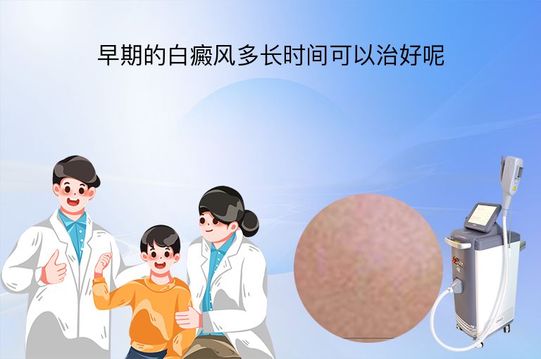 早期的白癜风多长时间可以治好呢”