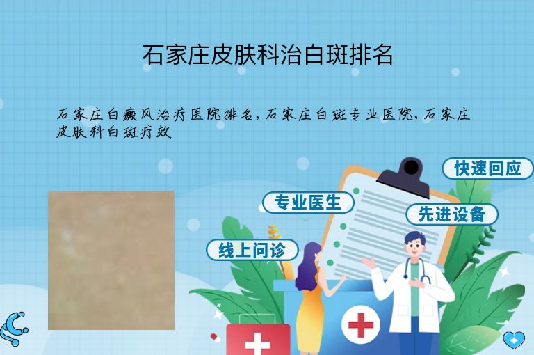 石家庄皮肤科治白斑排名”