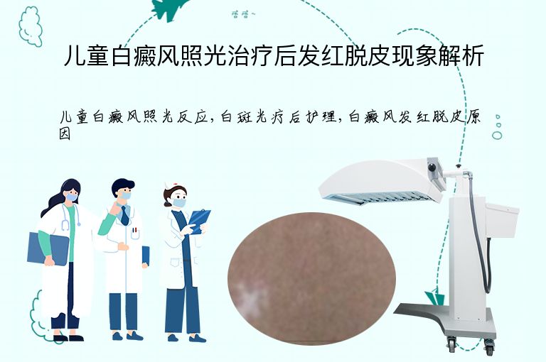 儿童白癜风照光治疗后发红脱皮现象解析”