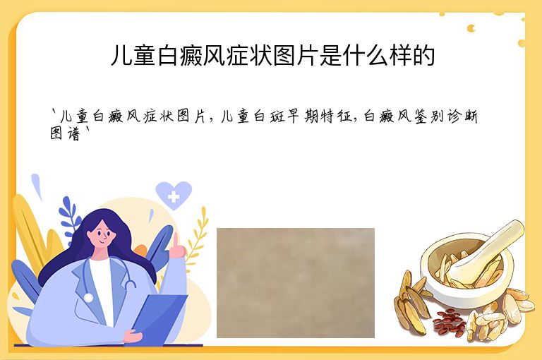 儿童白癜风症状图片是什么样的”