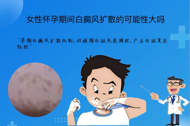 女性怀孕期间白癜风扩散的可能性大吗”