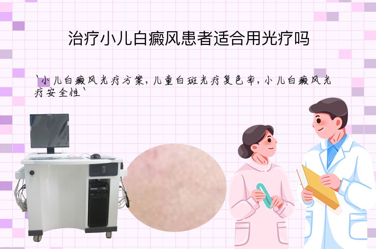 治疗小儿白癜风患者适合用光疗吗