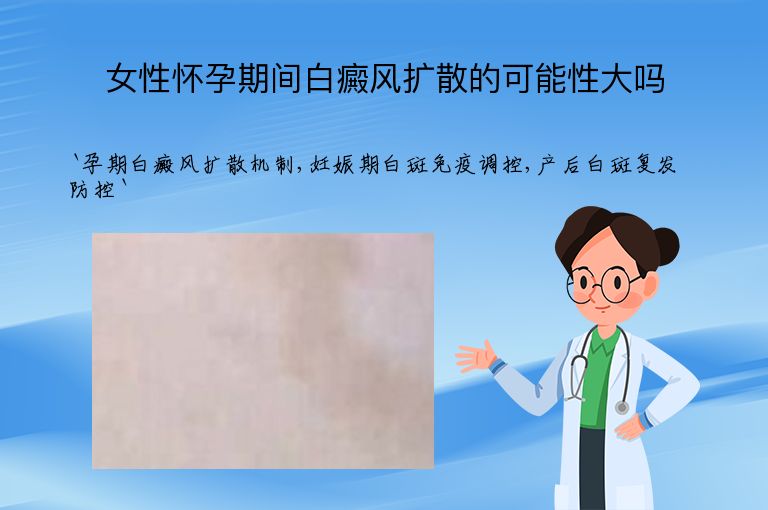 女性怀孕期间白癜风扩散的可能性大吗”