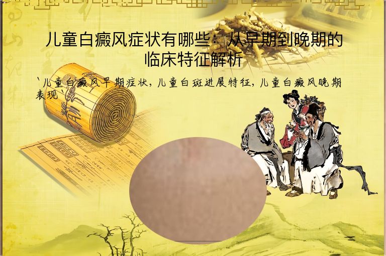 儿童白癜风症状有哪些:从早期到晚期的临床特征解析