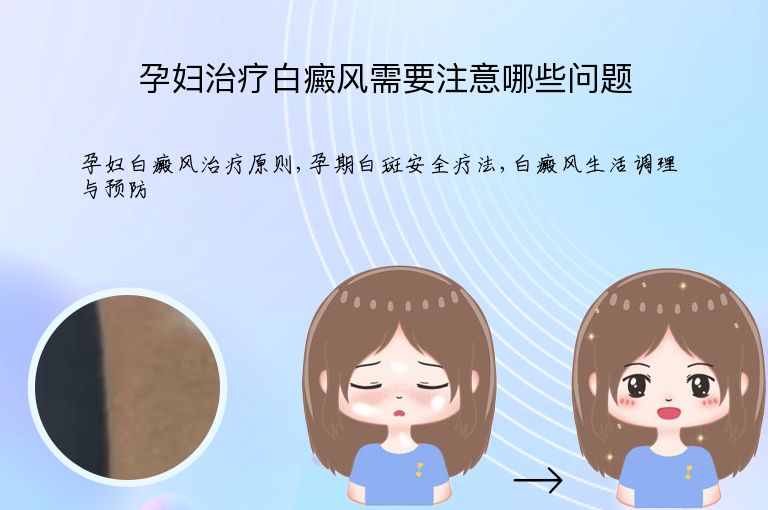 孕妇治疗白癜风需要注意哪些问题”