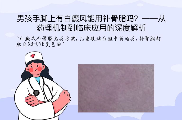 男孩手脚上有白癜风能用补骨脂吗？——从药理机制到临床应用的深度解析