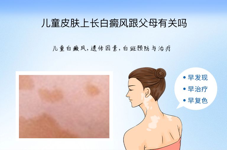 儿童皮肤上长白癜风跟父母有关吗”