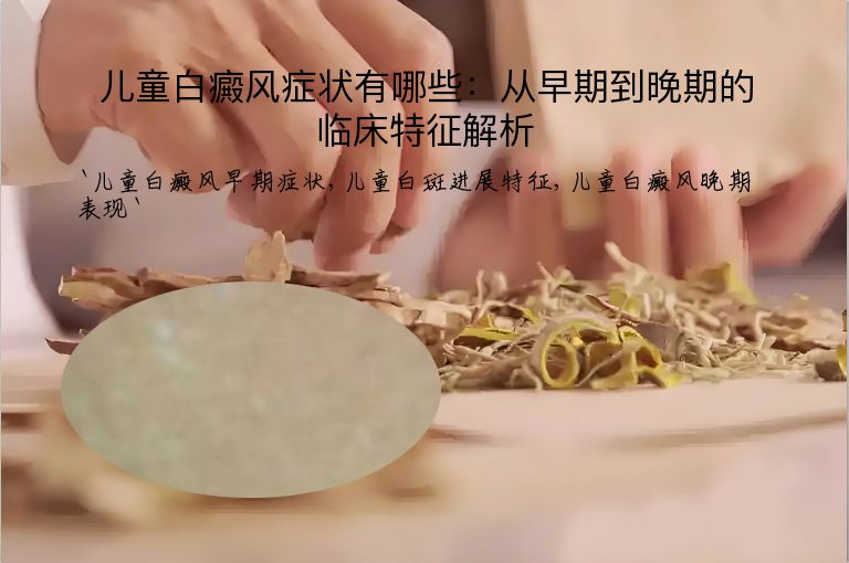 儿童白癜风症状有哪些:从早期到晚期的临床特征解析