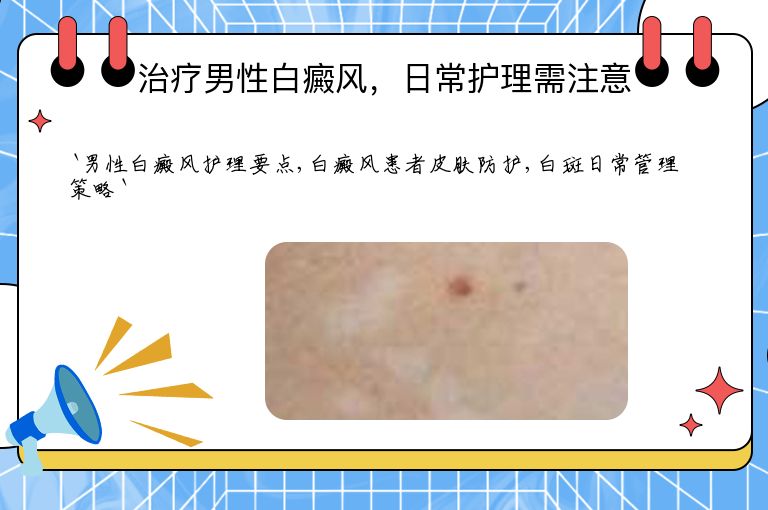 治疗男性白癜风，日常护理需注意