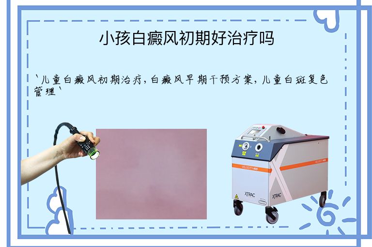 小孩白癜风初期好治疗吗