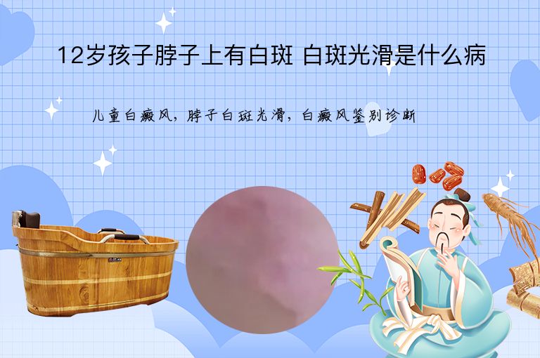 12岁孩子脖子上有白斑 白斑光滑是什么病”