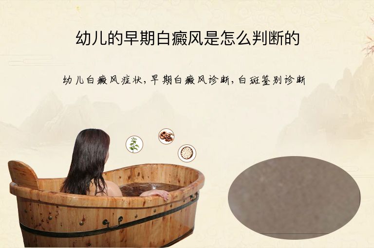 https://www.bdfsjzyy.com/d/file/p/631b2a6f587d3004f4e8528a98f9b809.jpeg