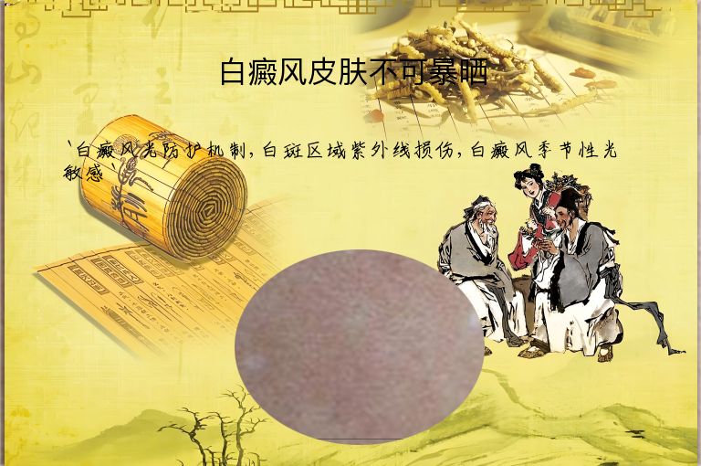 白癜风皮肤不可暴晒