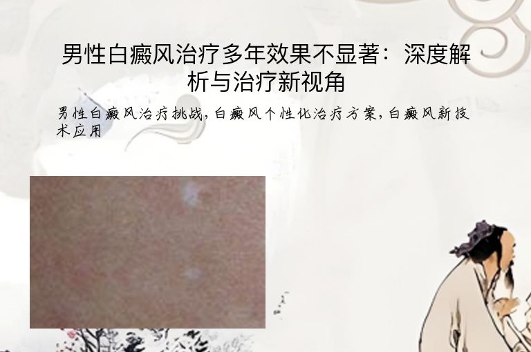 男性白癜风治疗多年效果不显著:深度解析与治疗新视角”