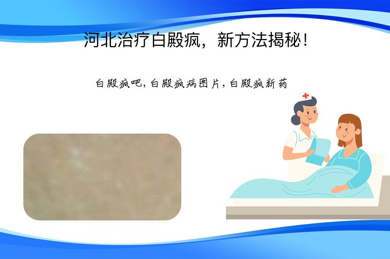 https://www.bdfsjzyy.com/d/file/p/3fd26293bc5e41c675b3d1a3bbd0c42f.jpeg
