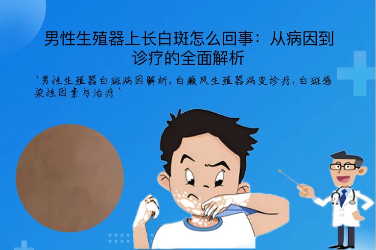 男性生殖器上长白斑怎么回事:从病因到诊疗的全面解析