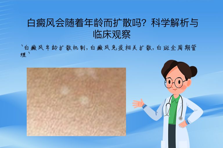 白癜风会随着年龄而扩散吗？科学解析与临床观察”