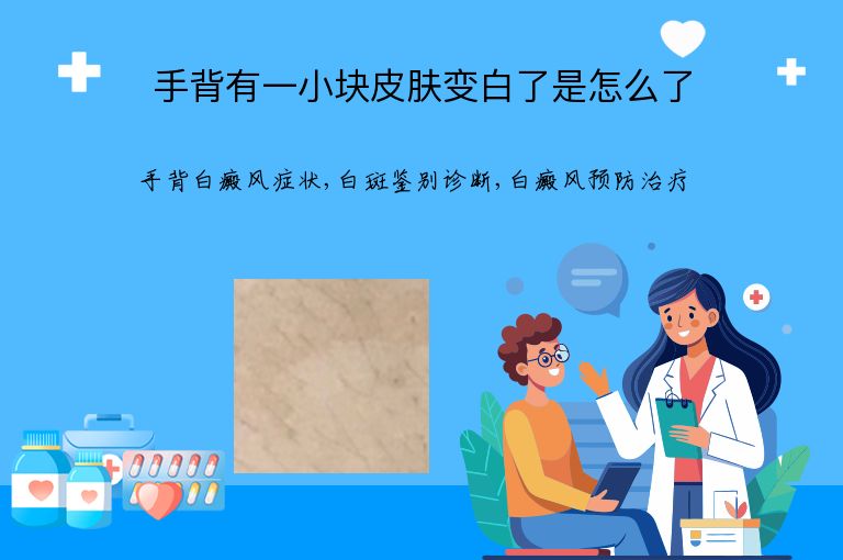 https://www.bdfsjzyy.com/d/file/p/8ab7aa8f720c627e2b40e94f359980cd.jpeg