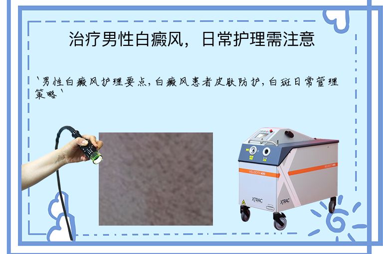 治疗男性白癜风,日常护理需注意
