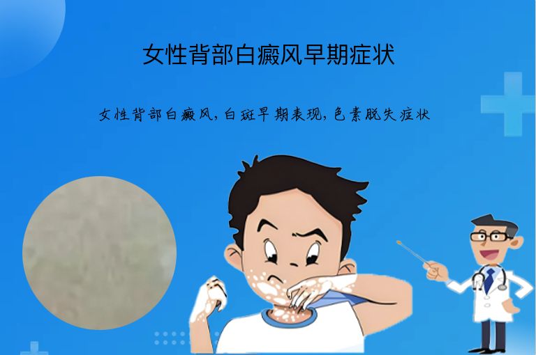 女性背部白癜风早期症状”